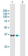 Anti-GNPTG Mouse Polyclonal Antibody