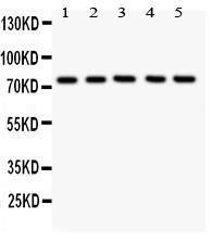 Anti-12 Lipoxygenase Polyclonal Antibody