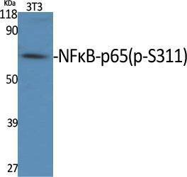 Anti-NF-kB p65 Rabbit Polyclonal Antibody