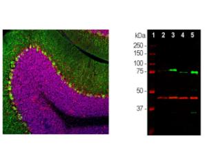 Left: Rat cerebellum stained for MeCP2 (red) and calbindin (green). Right: WB analysis with mouse anti-MeCP2 (green) and chicken anti-GAP43 (red). (2) rat whole brain, (3) nuclear fraction of rat brain, (4) mouse whole brain, (5) nuclear fraction of mouse brain.