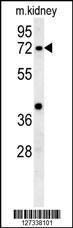 Anti-KLHL6 Rabbit Polyclonal Antibody (AP (Alkaline Phosphatase))