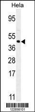 Anti-FOXL2 Rabbit Polyclonal Antibody (AP (Alkaline Phosphatase))