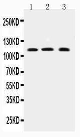 Anti-TRPC4 Polyclonal Antibody