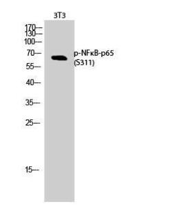 Anti-NF-kB p65 Rabbit Polyclonal Antibody