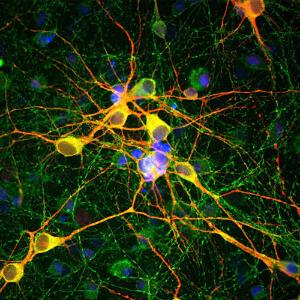 Immunofluorescent analysis of cortical neuron-glial culture from E20 rat stained with Anti-Tau Antibody (1:1,000/green) and Anti-MAP2 Antibody (A85363/1:5,000/red)