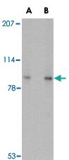 Anti-VPS53 Rabbit Polyclonal Antibody