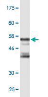 Anti-LDB3 Mouse Monoclonal Antibody [clone: 2C1]