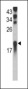 Anti-UBE2L3 Rabbit Polyclonal Antibody (AP (Alkaline Phosphatase))