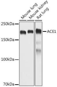 Anti-Angiotensin Converting Enzyme 1 Antibody (A11567)