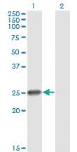 Anti-RNF114 Mouse Monoclonal Antibody [clone: S2]