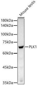 Anti-PLK1 antibody