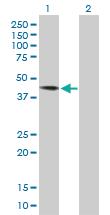 Anti-DYX1C1 Rabbit Polyclonal Antibody