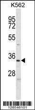 Anti-ELAVL2 Rabbit Polyclonal Antibody (AP (Alkaline Phosphatase))