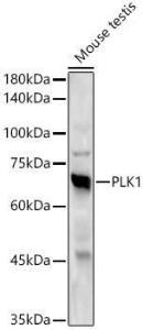 Anti-PLK1 antibody