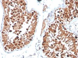 Immunohistochemical analysis of formalin-fixed, paraffin-embedded human testis using Anti-Inhibin alpha Antibody [INHA/4265]