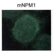 Anti-NPM1 Rabbit Polyclonal Antibody