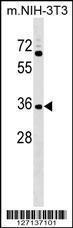 Anti-GPATCH11 Rabbit Polyclonal Antibody (FITC (Fluorescein Isothiocyanate))