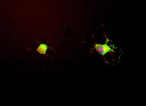 We obtained E18 hippocampal neurons and grew them for seven days