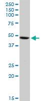 Anti-DYX1C1 Rabbit Polyclonal Antibody