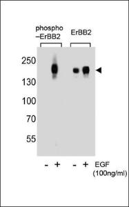 Anti-ERBB2 Rabbit Polyclonal Antibody