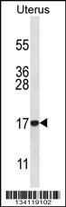 Anti-CFL2 Rabbit Polyclonal Antibody