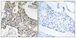 Antibody anti-GPSN2 100 µg