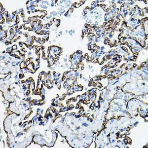 Immunohistochemistry analysis of paraffin-embedded rat lung using Anti-Angiotensin Converting Enzyme 1 Antibody (A11567) at a dilution of 1:100 (40X lens). Perform high pressure antigen retrieval with 10 mM citrate buffer pH 6.0 before commencing with IHC staining protocol