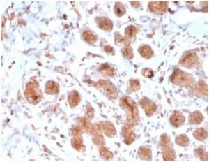 Immunohistochemical analysis of formalin-fixed, paraffin-embedded human breast tissue using Anti-Lactoferrin Antibody [LTF/4073]