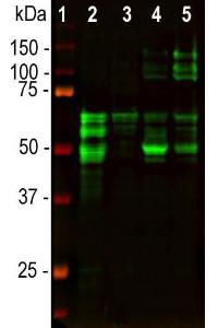 Western blot analysis of different tissue lysates using Anti-Tau Antibody (1:2,000/green): [1] protein standard (red), [2] rat brain, [3] rat spinal cord, [4] mouse brain, [5] mouse spinal cord