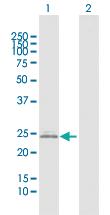 Anti-IGKC Rabbit Polyclonal Antibody