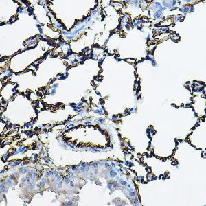 Immunohistochemistry analysis of paraffin-embedded mouse lung using Anti-Angiotensin Converting Enzyme 1 Antibody (A11567) at a dilution of 1:100 (40X lens). Perform high pressure antigen retrieval with 10 mM citrate buffer pH 6.0 before commencing with IHC staining protocol