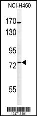 Anti-BBS10 Rabbit Polyclonal Antibody