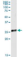 Anti-IGKC Rabbit Polyclonal Antibody