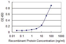 Anti-RNF114 Mouse Monoclonal Antibody [clone: S2]