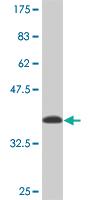 Anti-NARF Mouse Monoclonal Antibody [clone: 7D9]