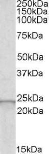 Anti-GPX2 antibody