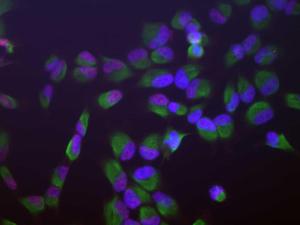 Human HeLa cells stained with Anti-SF3B4 Antibody (red), Anti-Vimentin Antibody (A85421/green) and DNA (blue, stained with DAPI)