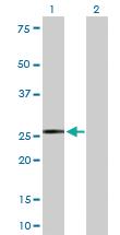 Anti-IGKC Rabbit Polyclonal Antibody