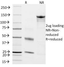 SDS-PAGE analysis of Anti-CD45RO Antibody [T200/797] under non-reduced and reduced conditions; showing intact IgG and intact heavy and light chains, respectively. SDS-PAGE analysis confirms the integrity and purity of the antibody.