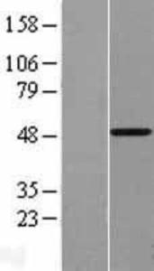 Anti-DNMT1 Mouse Monoclonal Antibody [clone: 60B1220.1]