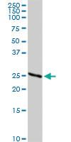 Anti-IGKC Rabbit Polyclonal Antibody