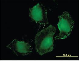 Anti-TLR9 Mouse Monoclonal Antibody [clone: 1E8]