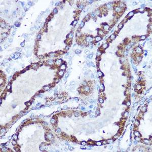 Immunohistochemistry analysis of paraffin-embedded rat kidney using Anti-SOD2/MnSOD Antibody (A306407) at a dilution of 1:100 (40x lens) Perform microwave antigen retrieval with 10 mM Tris/EDTA buffer pH 90 before commencing with IHC staining protocol