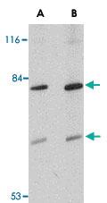 Anti-TMC8 Rabbit Polyclonal Antibody