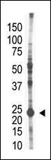 Anti-UBE2S Rabbit Polyclonal Antibody (PE (Phycoerythrin))