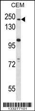 Anti-ATG2B Rabbit Polyclonal Antibody (HRP (Horseradish Peroxidase))