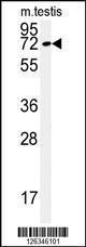 Anti-KLHL9 Rabbit Polyclonal Antibody (APC (Allophycocyanin))