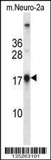 Anti-NME1 Rabbit Polyclonal Antibody