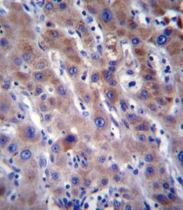 Anti-FADS2 Rabbit Polyclonal Antibody (FITC (Fluorescein Isothiocyanate))