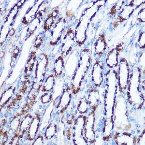 Immunohistochemistry analysis of paraffin-embedded mouse kidney using Anti-SOD2/MnSOD Antibody (A306407) at a dilution of 1:100 (40x lens) Perform microwave antigen retrieval with 10 mM Tris/EDTA buffer pH 90 before commencing with IHC staining protocol